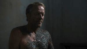 stone sickness game of thrones